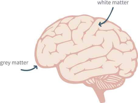 white-matter-grey-matter-dementia.png